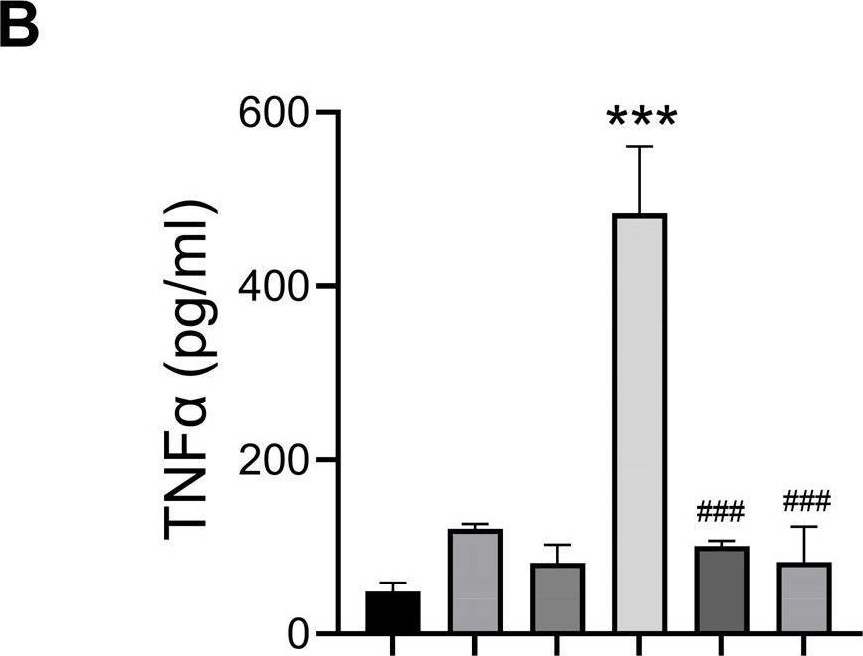 Fig.5.B showing Enzyme-linked immunosorbent assay from the publication: Methamphetamine Enhancement of HIV-1 gp120-Mediated NLRP3 Inflammasome Activation and Resultant Proinflammatory Responses in Rat Microglial Cultures.