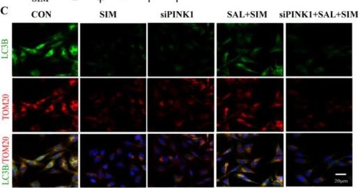 Fig.7.C showing Immunocytochemistry-immunofluorescence in a Homo sapiens (Human) sample from the publication: Salidroside Protects Against Simazine-Induced Neurotoxicity by Activating PINK1/Parkin Mitophagy.