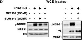 Fig.3.D showing Western Blotting from the publication: Interaction of NDRG1 and MRE11 Modulates DNA Replication and Repair.