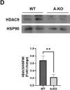Fig.2.D showing Western Blotting in a Homo sapiens (Human) sample from the publication: Sex-Dependent Role of Adipose Tissue HDAC9 in Diet-Induced Obesity and Metabolic Dysfunction.