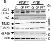 Fig.8.A showing Western Blotting from the publication: Nuclear p53-mediated repression of autophagy involves PINK1 transcriptional down-regulation.