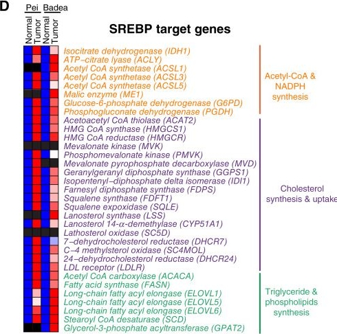 Fig.8.D from the publication: SREBP-Dependent Regulation of Lipid Homeostasis Is Required for Progression and Growth of Pancreatic Ductal Adenocarcinoma.