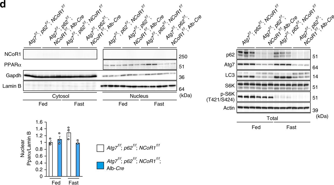 Autophagy regulates lipid metabolism through selective turnover of NCoR1.
