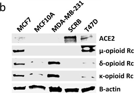 Fig.3.B showing Western Blotting in a Homo sapiens (Human) sample from the publication: Generation of 2,000 breast cancer metabolic landscapes reveals a poor prognosis group with active serotonin production.