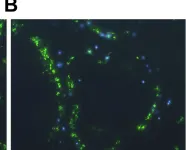 Fig.6.B showing Immunocytochemistry-immunofluorescence in a Mus musculus (House mouse) sample from the publication: VCAM-1 and VLA-4 modulate dendritic cell IL-12p40 production in experimental visceral leishmaniasis.