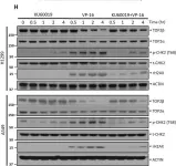 Fig.4.H showing Western Blotting in a Homo sapiens (Human) sample from the publication: ATM inhibitor KU60019 synergistically sensitizes lung cancer cells to topoisomerase II poisons by multiple mechanisms.