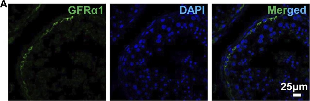 Fig.1.A showing Immunohistochemistry-immunofluorescence in a Homo sapiens (Human) sample from the publication: Xenotransplantation of Human Spermatogonia Into Various Mouse Recipient Models.