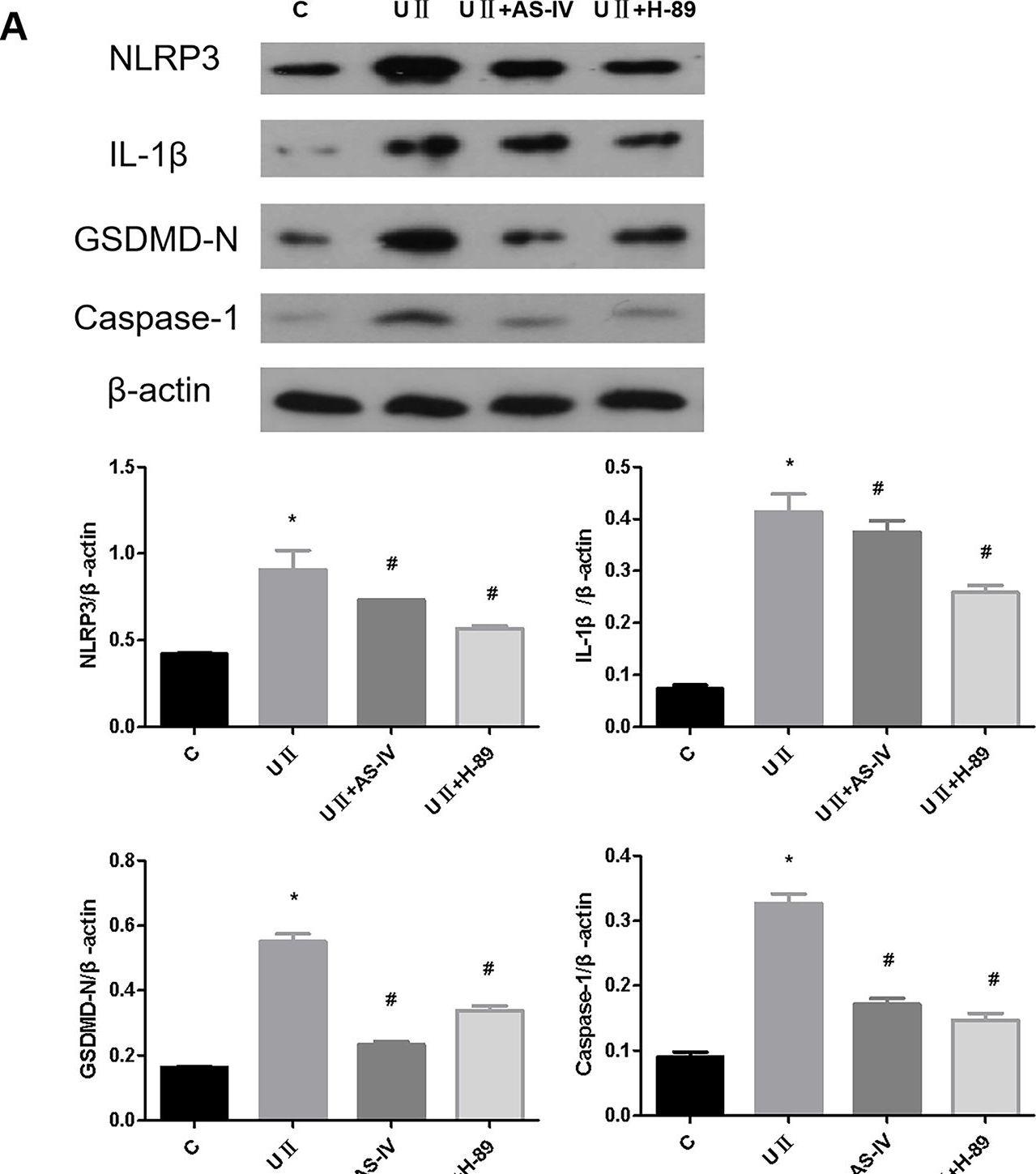 Fig.6.A showing Western Blotting in a Rattus norvegicus (Rat) sample from the publication: Astragaloside IV alleviates renal fibrosis by inhibiting renal tubular epithelial cell pyroptosis induced by urotensin II through regulating the cAMP/PKA signaling pathway.
