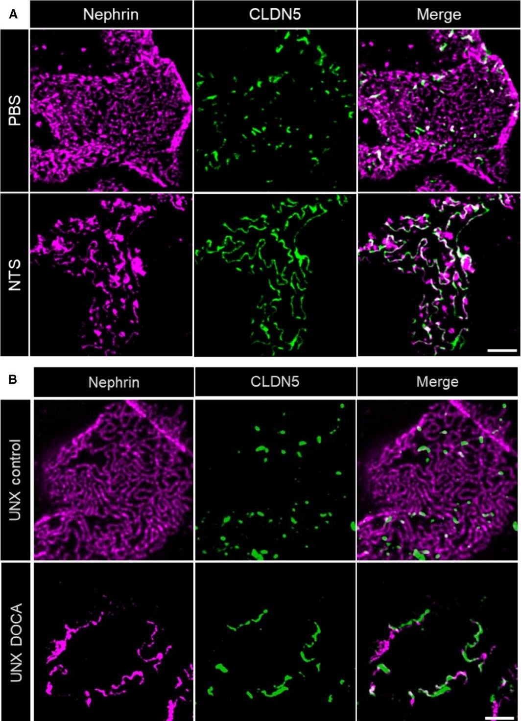 Super-resolved local recruitment of CLDN5 to filtration slits implicates a direct relationship with podocyte foot process effacement.