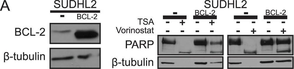 Fig.3.A showing Western Blotting from the publication: The sensitivity of diffuse large B-cell lymphoma cell lines to histone deacetylase inhibitor-induced apoptosis is modulated by BCL-2 family protein activity.