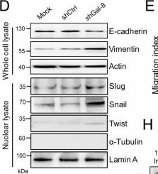 Fig.2.D showing Western Blotting from the publication: B4GALT1-dependent galectin-8 binding with TGF-β receptor suppresses colorectal cancer progression and metastasis.