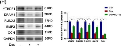 Fig.1.H showing Western Blotting in a Mus musculus (House mouse) sample from the publication: m6A-modified DRAM1 recognized by YTHDF1 regulates autophagy during dexamethasone-induced osteogenic inhibition.