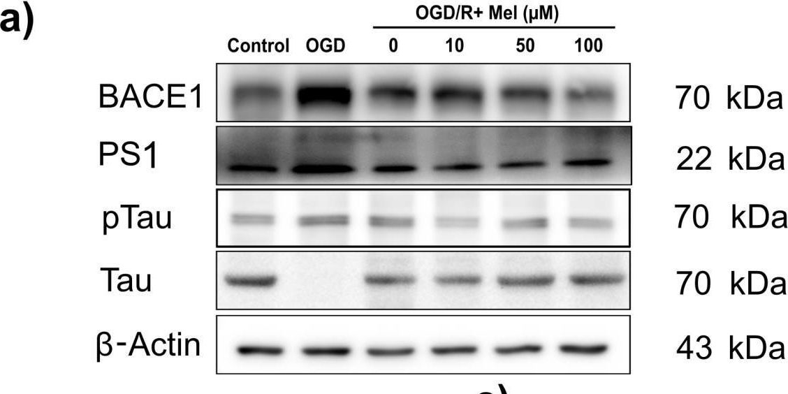 Fig.5.A showing Western Blotting in a Homo sapiens (Human) sample from the publication: Melatonin Inhibits Hypoxia-Induced Alzheimer's Disease Pathogenesis by Regulating the Amyloidogenic Pathway in Human Neuroblastoma Cells.