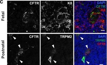 Fig.6.C showing Immunohistochemistry-immunofluorescence from the publication: Single-cell transcriptional profiling of human thymic stroma uncovers novel cellular heterogeneity in the thymic medulla.