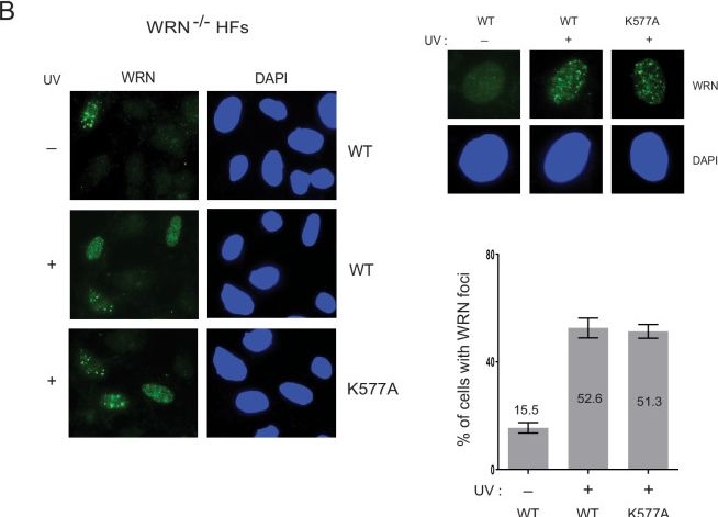 Fig.1.B showing Immunocytochemistry-immunofluorescence from the publication: WRN and WRNIP1 ATPases impose high fidelity on translesion synthesis by Y-family DNA polymerases.