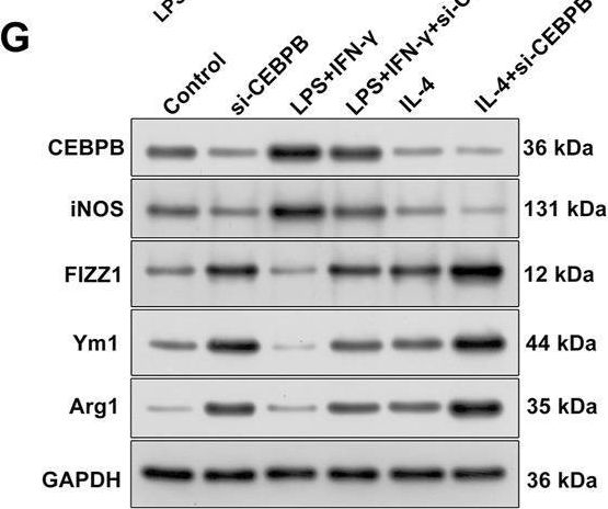 Fig.8.G showing Western Blotting from the publication: Characterization of an Aging-Based Diagnostic Gene Signature and Molecular Subtypes With Diverse Immune Infiltrations in Atherosclerosis.
