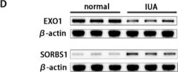 Fig.5.D showing Western Blotting from the publication: Integrative circRNA landscape of intrauterine adhesions: putative ceRNA axes and circRNA-associated splicing usage linked to contractility and immunity.