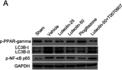 Phospho-PPAR Gamma (ser273) Polyclonal Antibody – Bioss