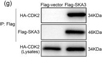Fig.6.G showing Western Blotting in a Homo sapiens (Human) sample from the publication: SKA3 Promotes tumor growth by regulating CDK2/P53 phosphorylation in hepatocellular carcinoma.