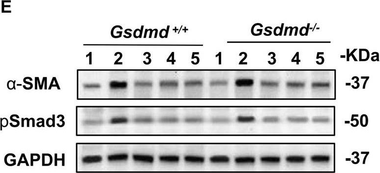 Fig.7.E showing Western Blotting in a Mus musculus (House mouse) sample from the publication: GSDMD-dependent neutrophil extracellular traps promote macrophage-to-myofibroblast transition and renal fibrosis in obstructive nephropathy.