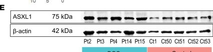 Fig.1.E showing Western Blotting in a Homo sapiens (Human) sample from the publication: Multiomics of Bohring-Opitz syndrome truncating ASXL1 mutations identify canonical and noncanonical Wnt signaling dysregulation.