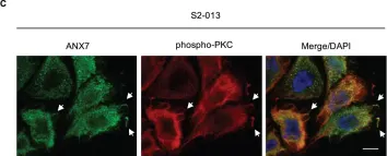 Fig.3.C showing Immunocytochemistry-immunofluorescence from the publication: BART inhibits pancreatic cancer cell invasion by PKCα inactivation through binding to ANX7.