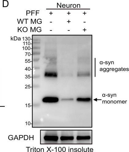 Fig.5.D showing Western Blotting from the publication: Microglial Melatonin Receptor 1 Degrades Pathological Alpha-Synuclein Through Activating LC3-Associated Phagocytosis In&nbsp;Vitro.