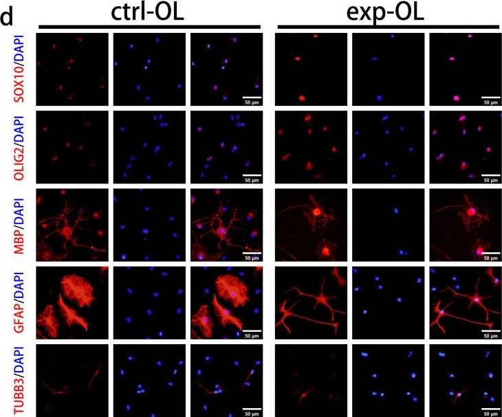 Fig.5.D showing Immunocytochemistry-immunofluorescence in a Mus musculus (House mouse) sample from the publication: SOX10 Overexpression Enhances the Oligodendrocyte Lineage Commitment of iOPCs In Vitro by Reshaping Their Chromatin Binding Landscape.