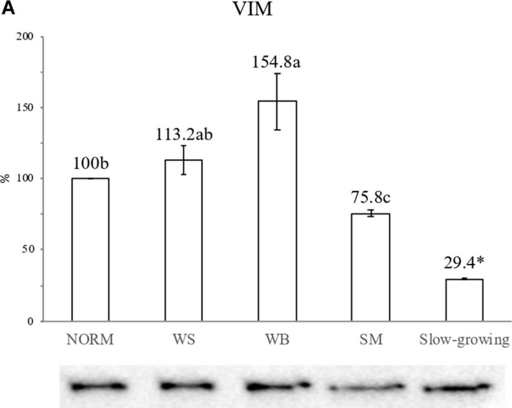 Distribution and Expression of Vimentin and Desmin in Broiler Pectoralis major Affected by the Growth-Related Muscular Abnormalities.