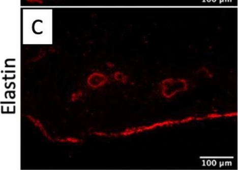 Fig.3.C showing Immunohistochemistry-immunofluorescence from the publication: Porcine Small Intestinal Submucosa (SIS) as a Suitable Scaffold for the Creation of a Tissue-Engineered Urinary Conduit: Decellularization, Biomechanical and Biocompatibility Characterization Using New Approaches.