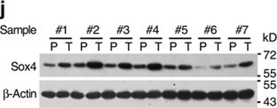 Fig.7.J showing Western Blotting in a Homo sapiens (Human) sample from the publication: LncSox4 promotes the self-renewal of liver tumour-initiating cells through Stat3-mediated Sox4 expression.