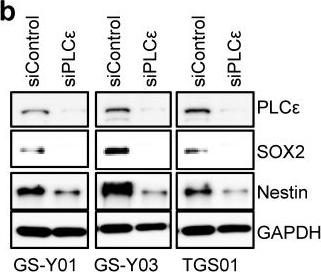Fig.3.B showing Western Blotting from the publication: Inhibition of the Phospholipase Cε-c-Jun N-Terminal Kinase Axis Suppresses Glioma Stem Cell Properties.