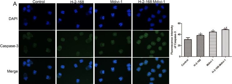 Fig.3.A showing Immunocytochemistry-immunofluorescence in an Echinococcus granulosus sample from the publication: Harmine derivative H-2-168 induces the death of Echinococcus granulosus by regulating mitochondrial fusion and fission.
