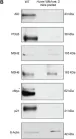 Fig.4.B showing Western Blotting from the publication: Huwe1 supports B-cell development, B-cell-dependent immunity, somatic hypermutation and class switch recombination by regulating proliferation.
