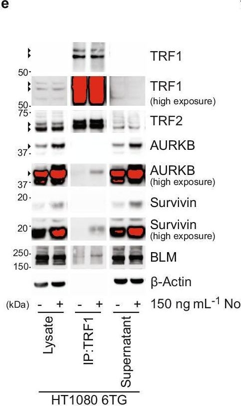 Fig.1.E showing Western Blotting in a Homo sapiens (Human) sample from the publication: A CPC-shelterin-BTR axis regulates mitotic telomere deprotection.
