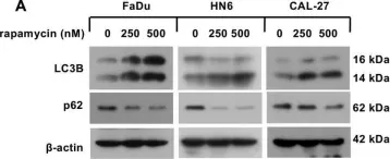 Fig.3.A showing Western Blotting from the publication: Afatinib induces pro-survival autophagy and increases sensitivity to apoptosis in stem-like HNSCC cells.