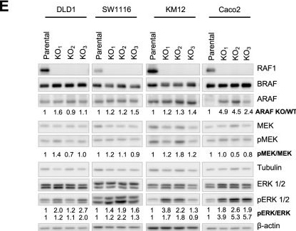 Fig.1.E showing Western Blotting from the publication: RAF1 contributes to cell proliferation and STAT3 activation in colorectal cancer independently of microsatellite and KRAS status.