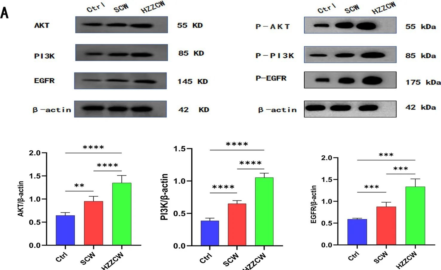 Fig.9.A showing Western Blotting from the publication: Terminalia chebula decoction-processed Aconitum kusnezoffii preserves therapeutic effects through regulation of metabolism and intestinal microbiota.