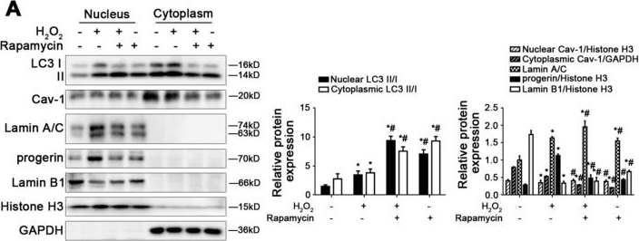 Fig.6.A showing Western Blotting from the publication: Nucleophagic Degradation of Progerin Ameliorates Defenestration in Liver Sinusoidal Endothelium Due to SIRT1-Mediated Deacetylation of Nuclear LC3.