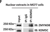 Fig.5.F showing Western Blotting from the publication: The Dual Function of KDM5C in Both Gene Transcriptional Activation and Repression Promotes Breast Cancer Cell Growth and Tumorigenesis.