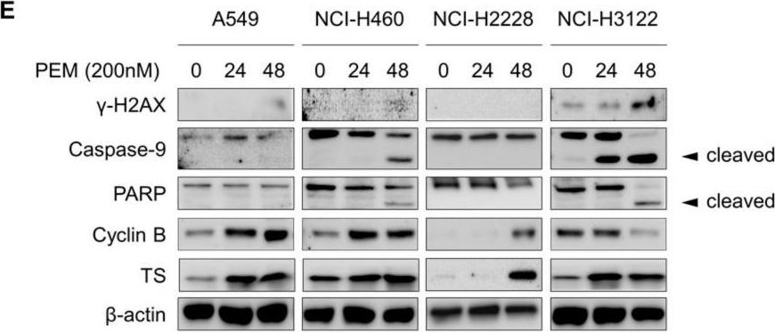 Fig.1.E showing Western Blotting in a Homo sapiens (Human) sample from the publication: Afatinib Overcomes Pemetrexed-Acquired Resistance in Non-Small Cell Lung Cancer Cells Harboring an EML4-ALK Rearrangement.