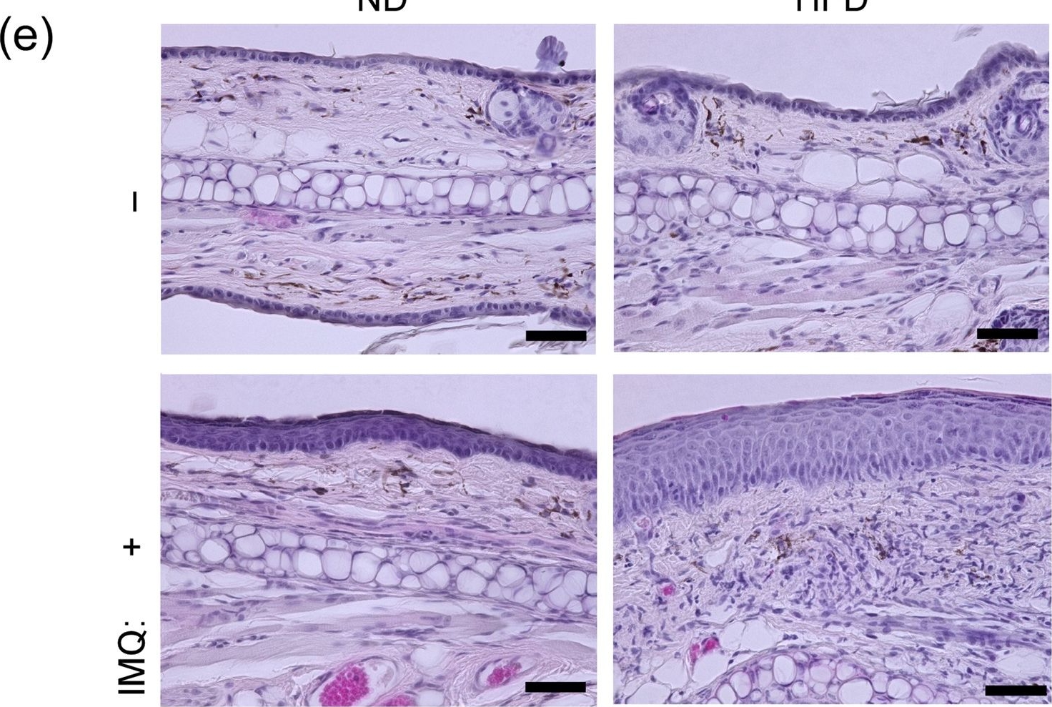 Fig.1.E showing Immunohistochemistry in a Mus musculus (House mouse) sample from the publication: High fat diet exacerbates murine psoriatic dermatitis by increasing the number of IL-17-producing γδ T cells.