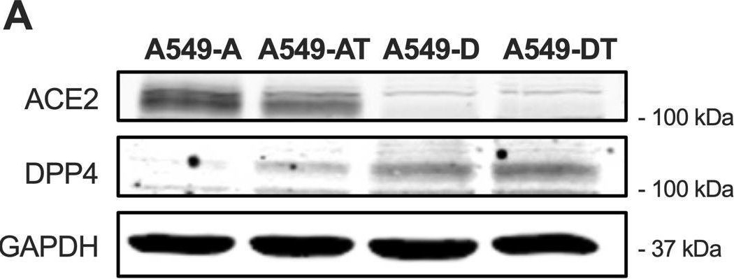 Fig.1.A showing Western Blotting in a Homo sapiens (Human) sample from the publication: Cellular sialoglycans are differentially required for endosomal and cell-surface entry of SARS-CoV-2 in lung cell lines.