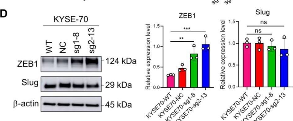 Fig.4.D showing Western Blotting in a Homo sapiens (Human) sample from the publication: CRISPR/Cas9 Screening Highlights PFKFB3 Gene as a Major Contributor to 5-Fluorouracil Resistance in Esophageal Cancer.