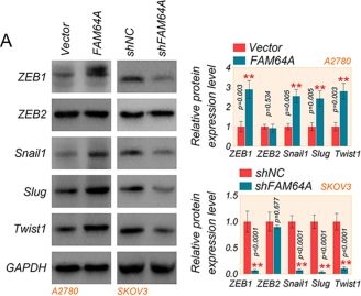 Fig.4.A showing Western Blotting in a Homo sapiens (Human) sample from the publication: FAM64A contributes to ovarian cancer proliferation and metastasis by suppressing TWIST1 ubiquitination and degradation.