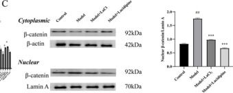 Fig.6.C showing Western Blotting from the publication: Lanthanum Chloride in Vascular Calcification: Effects on Nano-Hydroxyapatite and PPARγ/Wnt/β-Catenin.