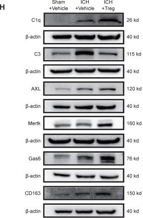 Fig.3.H showing Western Blotting from the publication: Gut microbiota depletion accelerates hematoma resolution and neurological recovery after intracerebral hemorrhage via p-coumaric acid-promoted Treg differentiation.