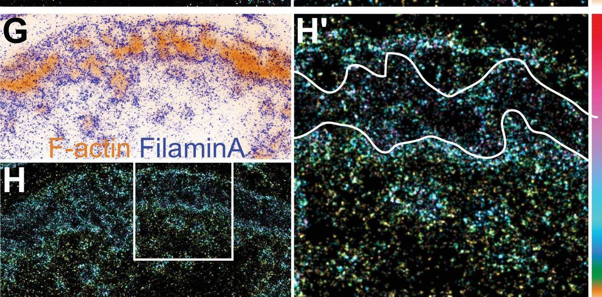 Fig.1.G showing Immunohistochemistry-immunofluorescence from the publication: Nanoscale architecture and coordination of actin cores within the sealing zone of human osteoclasts.