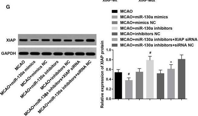 Fig.1.G showing Western Blotting in a Rattus norvegicus (Rat) sample from the publication: MicroRNA-130a regulates neurological deficit and angiogenesis in rats with ischaemic stroke by targeting XIAP.