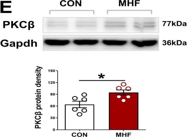 Fig.2.E showing Western Blotting from the publication: Perinatal Fat-Diets Increased Angiotensin II-Mediated Ca2+ through PKC-L-Type Calcium Channel Axis in Resistance Arteries via Agtr1a-Prkcb Gene Methylation.